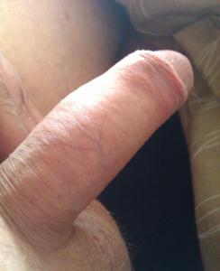 Attached Image